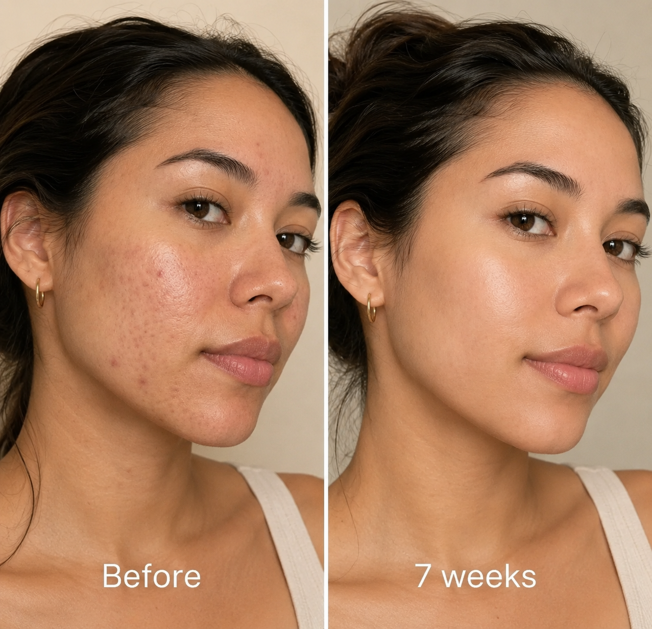 Aliara Clinical Acne Scar Repair Stick