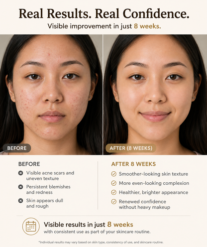 Aliara Clinical Acne Scar Repair Stick