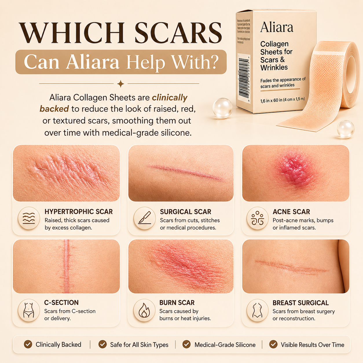 Aliara Benefit